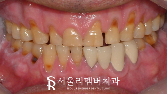 서울대입구역치과 에서 알려주는 관련 이미지 2