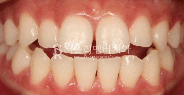 봉천동치과 관련 이미지 9