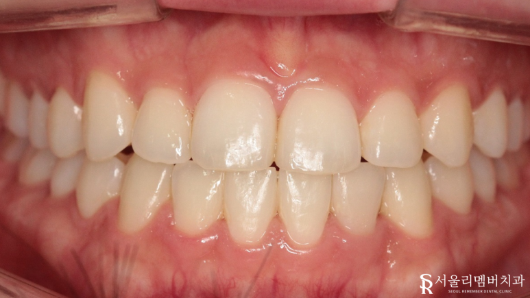 봉천동치과 관련 이미지 5