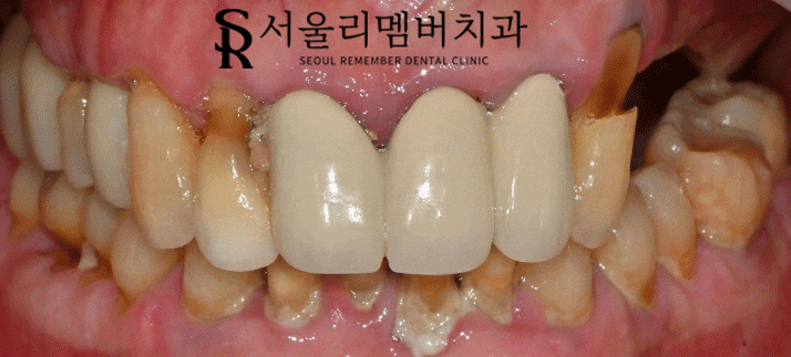 신풍역 치과 개인에게 딱 맞는 맞춤 계획으로-! 관련 이미지 6