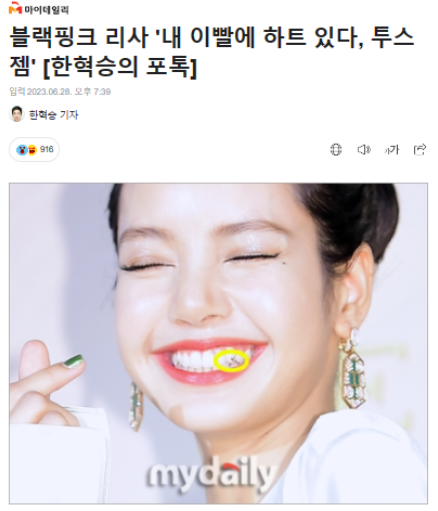서울대입구역 치과 투스잼 제거 꼭 전문가에게 해야 되는 이유와 관리 방법 관련 이미지 2