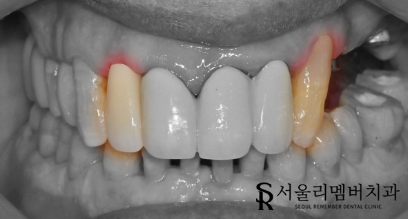 신풍역 치과 개인에게 딱 맞는 맞춤 계획으로-! 관련 이미지 5