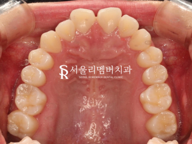 봉천동치과 관련 이미지 3