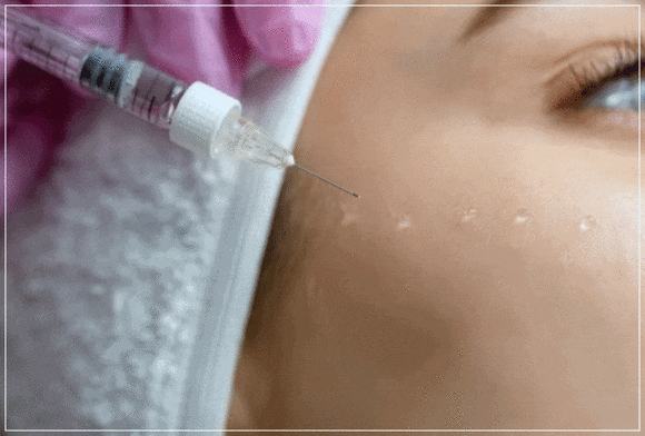 Hongdae Skin Booster: Which Is Better, Rejuran or Juvelook? image 5
