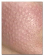 Hongdae Skin Booster: If You’re Debating Which Clinic to Go To image 6