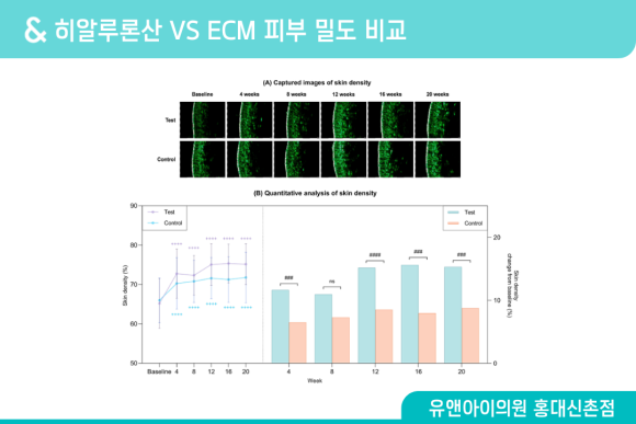 홍대 스킨부스터 종류 많은데, 내 피부엔 뭐가 맞을까 관련 이미지 5