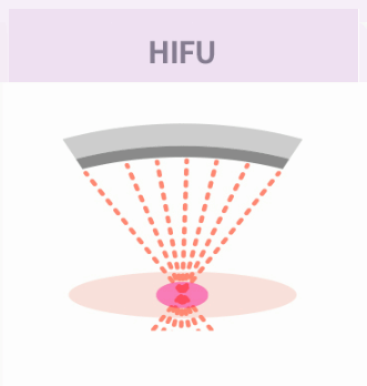 Shinchon Station Dermatology Clinic: How Sofwave Differs from Conventional Ultrasound Lifting image 3