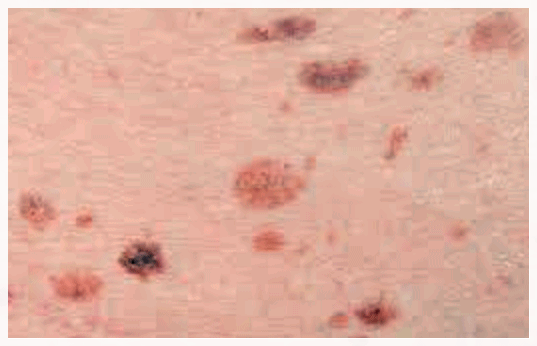 Why Do Recommended Dermatology Treatments in Mapo-gu Need to Be Repeated Several Times Before Their Effects Appear? image 4