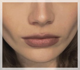 Hapjeong Station Dermatology Clinic: The Right Treatment for Your Skin Is Different for Everyone image 6