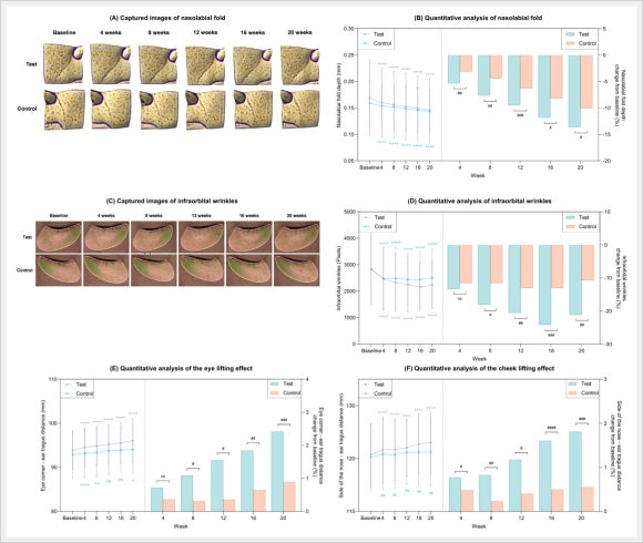 Hongdae Rituo: How Does It Compare with Aqua Shine Injections in Terms of Results? image 5