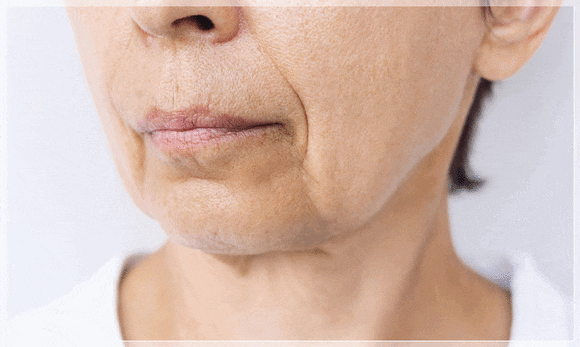 Recommended Dermatology Treatments in Shinchon That Vary Depending on the Pattern of Loss of Skin Elasticity image 1