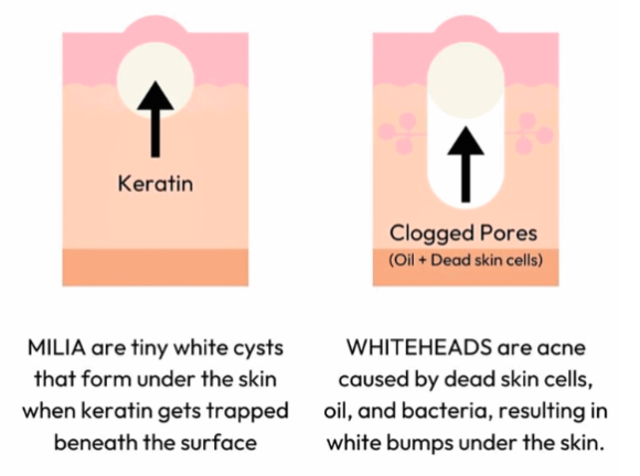 Shinchon Milia: If You’re Curious About What Makes a Good Clinic image 3