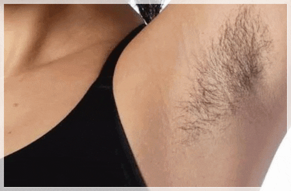 Is the Claim That Five Sessions Are Enough for Sinchon Underarm Hair Removal Really Reliable? image 3