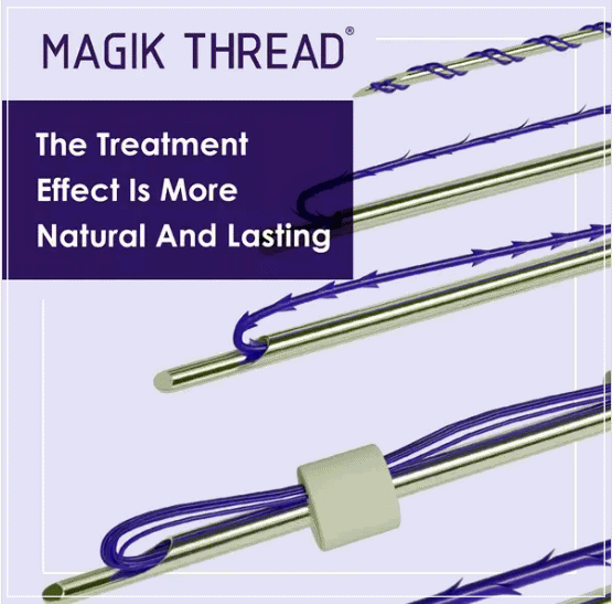 Comparing How Long Thread Lifting Lasts by Type: How to Choose Long-Lasting Threads image 6
