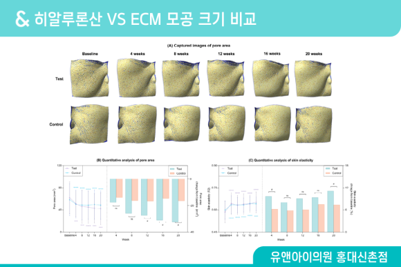 홍대 스킨부스터 종류 많은데, 내 피부엔 뭐가 맞을까 관련 이미지 7
