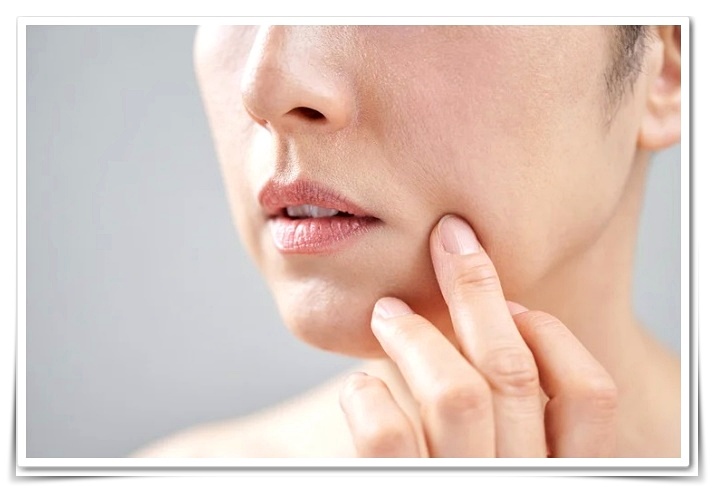 Shinchon Ulthera: Important Precautions You Must Know Before Getting It image 1