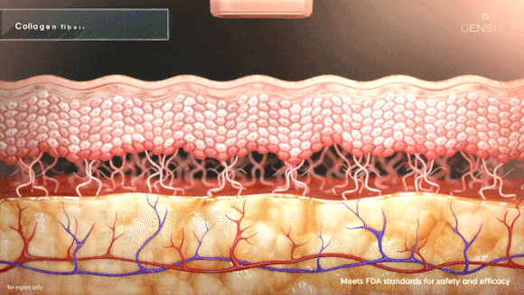 DENSITY High vs Classic: Which Tip Is Right for My Skin? image 2
