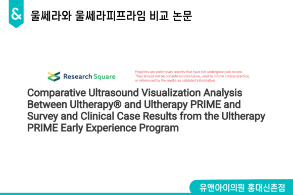 Hongdae Ulthera Prime Effects: Has the Precision Changed? image 1