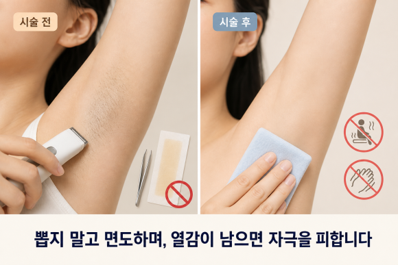 홍대 겨드랑이제모, 몇 번 받아야 하는지 솔직하게 얘기한다면? 관련 이미지 4