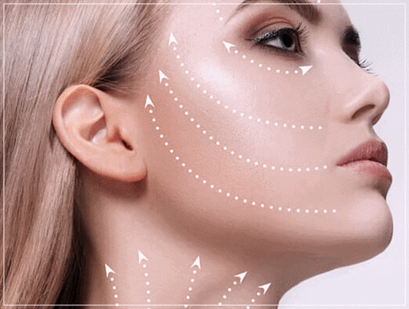 Comparing How Long Thread Lifting Lasts by Type: How to Choose Long-Lasting Threads image 1