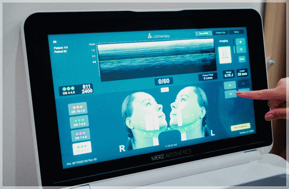 Hongdae Dermatology Clinic, Is It Okay to Have Several Lifting Procedures Together? image 5