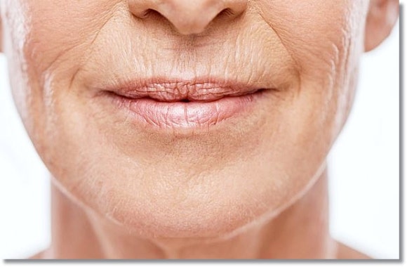 Essential Things to Check Before a Thermage Treatment in Hongdae image 2