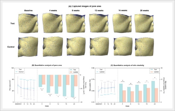 Hongdae Rituo: How Does It Compare with Aqua Shine Injections in Terms of Results? image 6