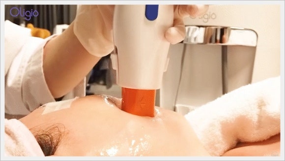 신촌 올리지오 내 피부에 맞는지 확인하는 방법은? 관련 이미지 2