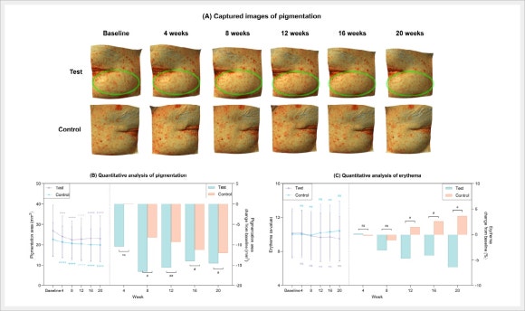 Hongdae Rituo: How Does It Compare with Aqua Shine Injections in Terms of Results? image 7