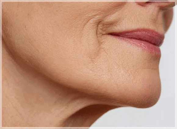 Why Do Recommended Dermatology Treatments in Mapo-gu Need to Be Repeated Several Times Before Their Effects Appear? image 5