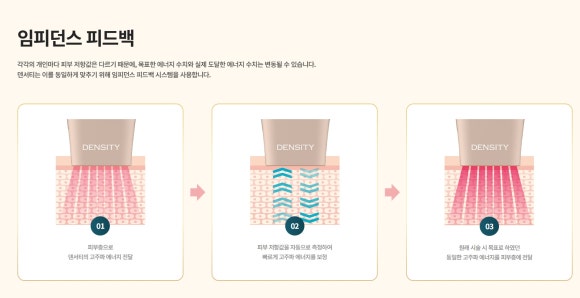 Density Alpha Tip vs. High Tip Comparison: What’s the Difference? image 5