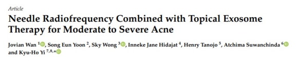 Potenza and Exosome Combination: What Skin Is It Effective For? image 3