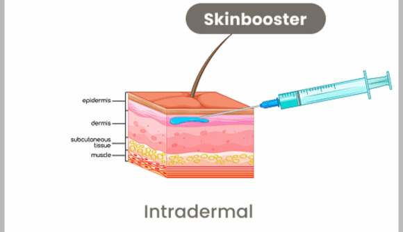 Hongdae Skin Booster: If You’re Debating Which Clinic to Go To image 5