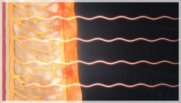 Wondering About the Lifting Effects of Shinchon Thermage? image 2