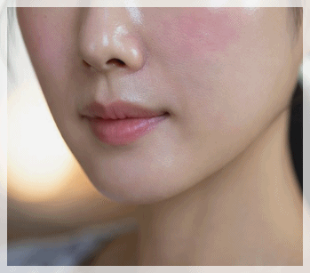 Seogyo-dong Dermatology Clinic: 3 Important Criteria to Check During a Consultation image 6