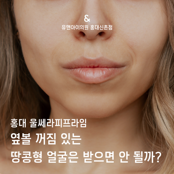 Hongdae Ultherapy PRIME: Should People with a Peanut-Shaped Face and Hollowed Cheeks Avoid It? image 1