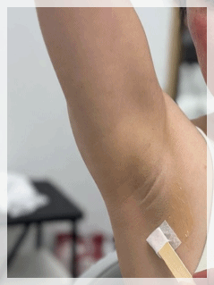 Hongdae Underarm Hair Removal: 3 Factors That Determine Satisfaction image 10