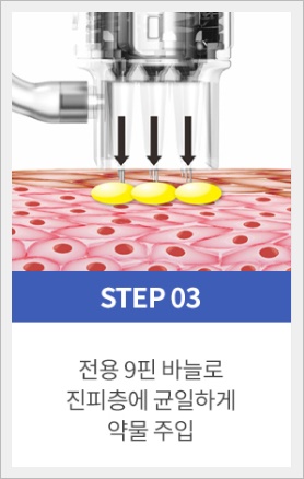 쥬베룩 하이쿡스로 받으면 통증이 덜할까? 관련 이미지 4