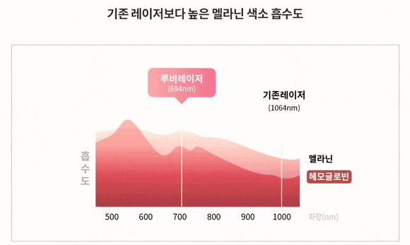 홍대 루비레이저, 한 번에 잡티가 정말 사라질까요? 관련 이미지 6