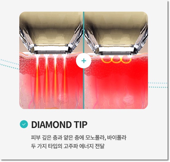 포텐자 리프팅 효과가 좋은 이유는? 관련 이미지 4