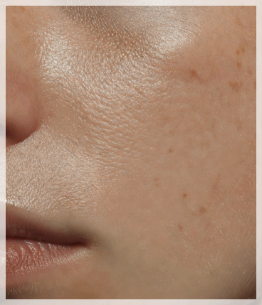 Hongdae Rejuran Healer: Why Satisfaction Differs Despite the Same Treatment image 8