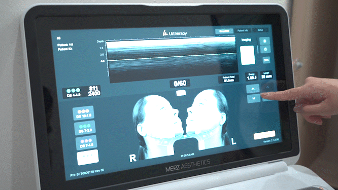 Hongdae Ulthera Prime: What Are the Standards of a Good Ulthera Clinic? image 2