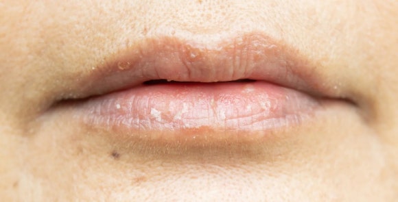 What Effects Can You Expect from Lip Rejuran? image 1