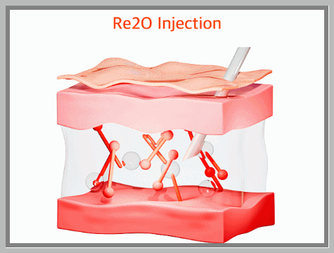Hongdae Ritwo: Why It Is Difficult to Judge Its Effects Based Only on Photos After One Treatment image 5