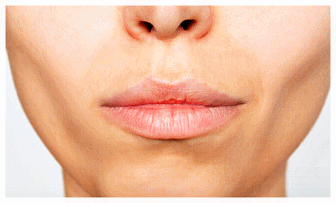Sinchon Thermage: If I Have Little Facial Fat, Could It Cause Cheek Hollowing? image 4