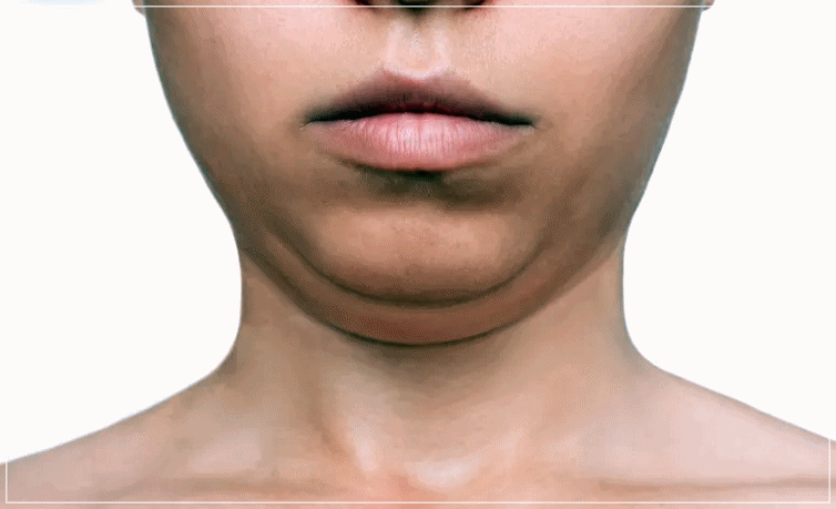 Hongdae Ulthera Prime: What Are the Standards of a Good Ulthera Clinic? image 1