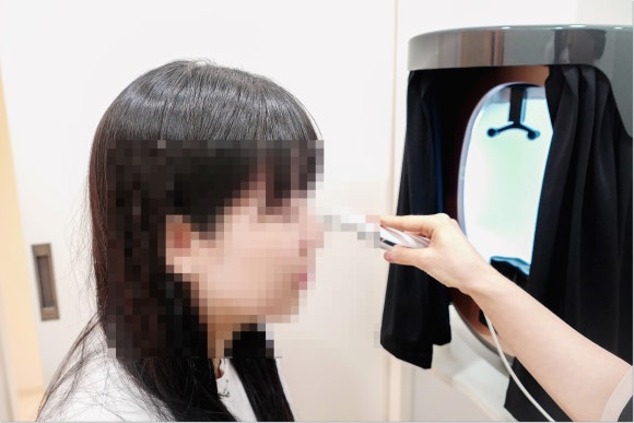 The Truth and Myths About Cheek Hollowing After Vero Lifting image 6