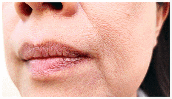 Hongdae InMode: Why the Effects of Forma and FX Must Be Properly Distinguished When Choosing Treatment image 6