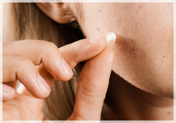 How to Avoid Scarring After Mole Removal in Sinchon image 5