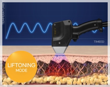 Trinity Reftonning: From Improving Skin Tone to Lifting image 3